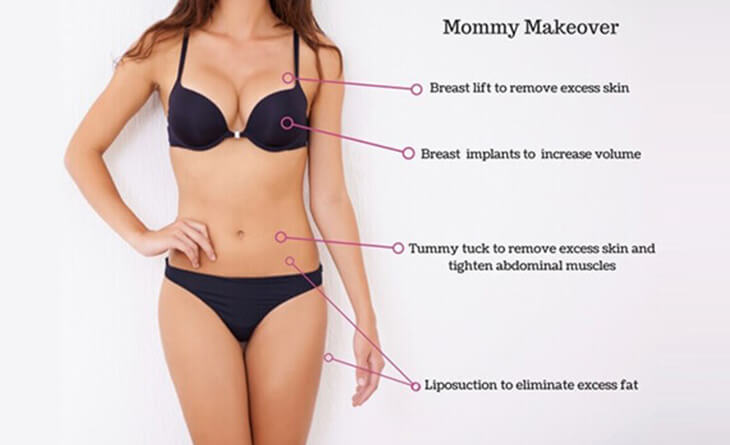 Mommy Makeover Surgery in Gurgaon
