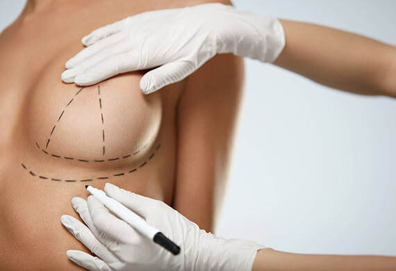 Breast Reduction Surgery in Gurgaon
