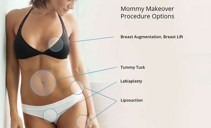 Mommy Makeover Surgery in Gurgaon