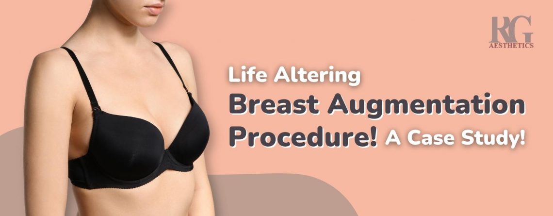 breast augmentation surgery