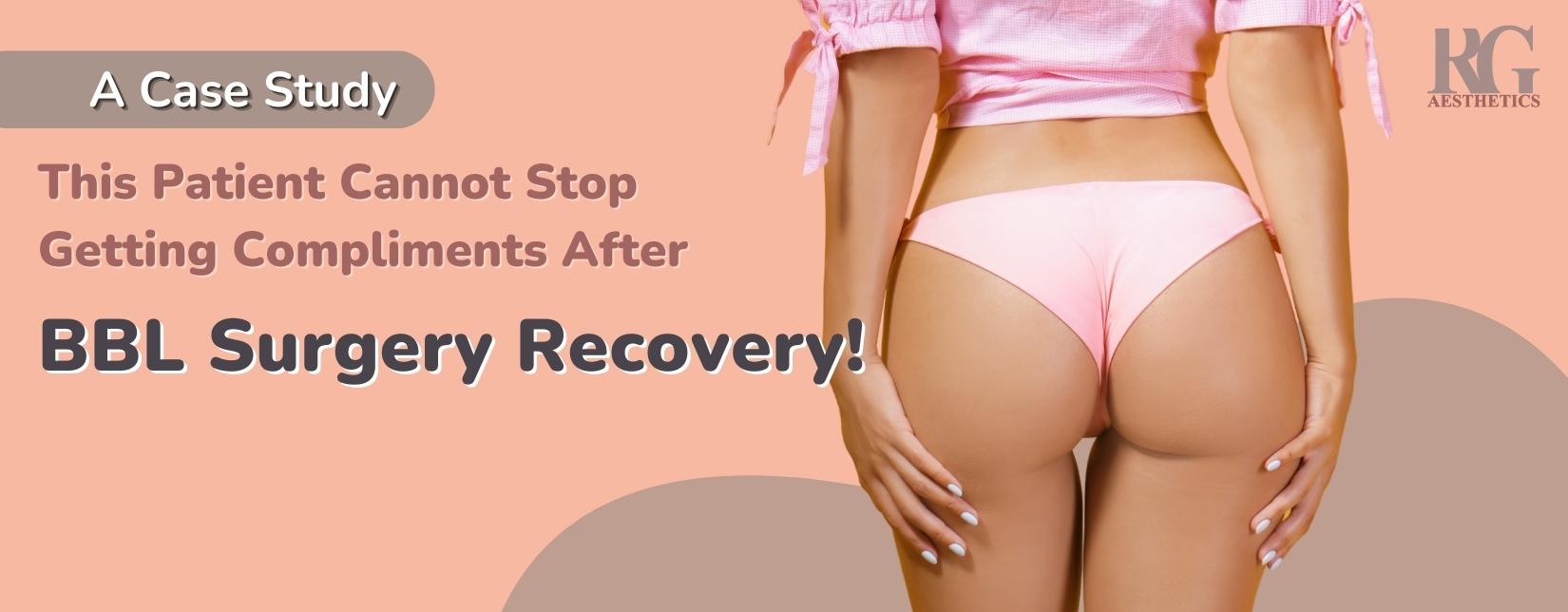Plastic Surgery Case Study - Buttock Implants in Asian Gluteal
