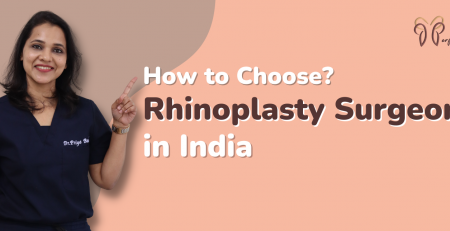 Rhinoplasty treatment