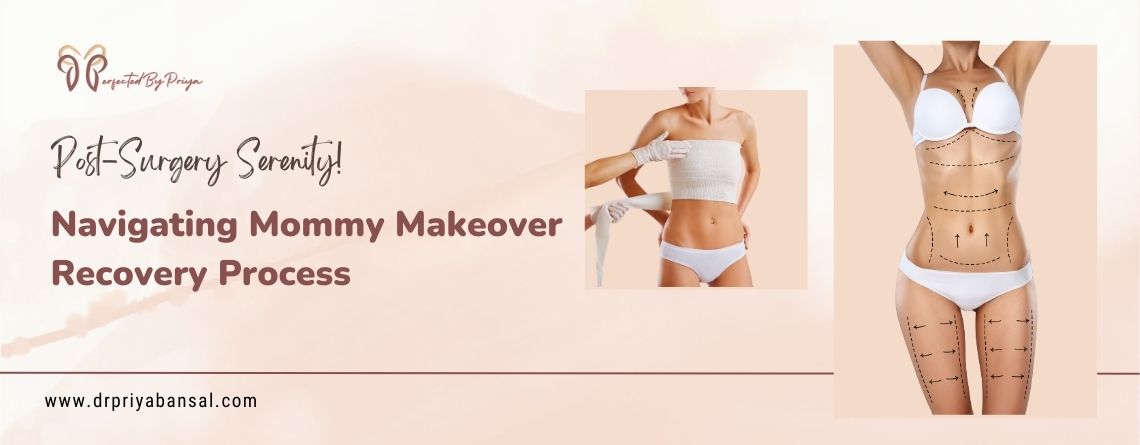 Mommy Makeover Recovery