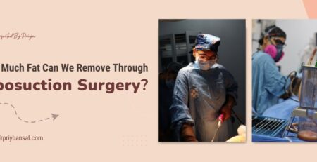 fat removal surgery in Delhi
