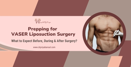 vaser liposuction surgery