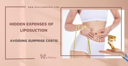 liposuction cost in delhi