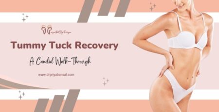 recovery after tummy tuck surgery