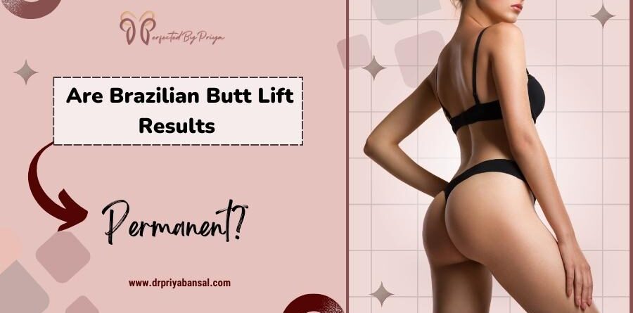 Brazilian Butt Lift Results