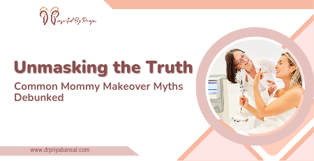 mommy makeover myths