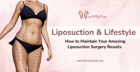liposuction surgery results