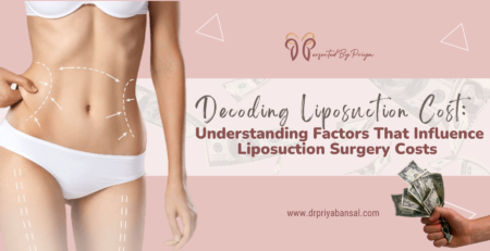 liposuction surgery cost in India