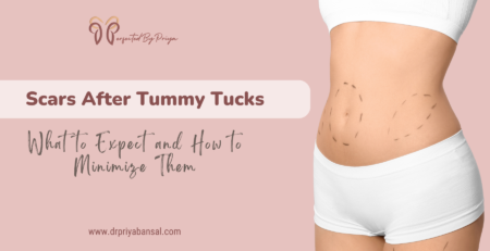 scars after tummy tuck surgery