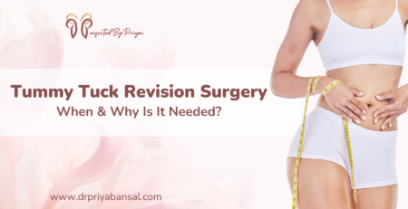 tummy tuck revision surgery