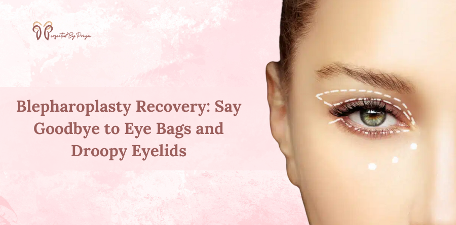 blepharoplasty recovery