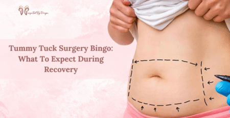 tummy tuck surgery in delhi