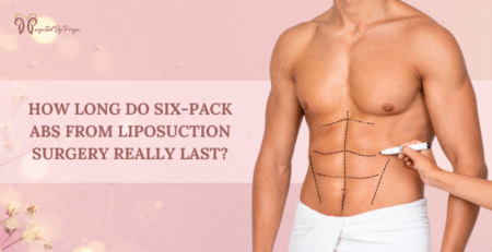 six pack abs surgery in delhi