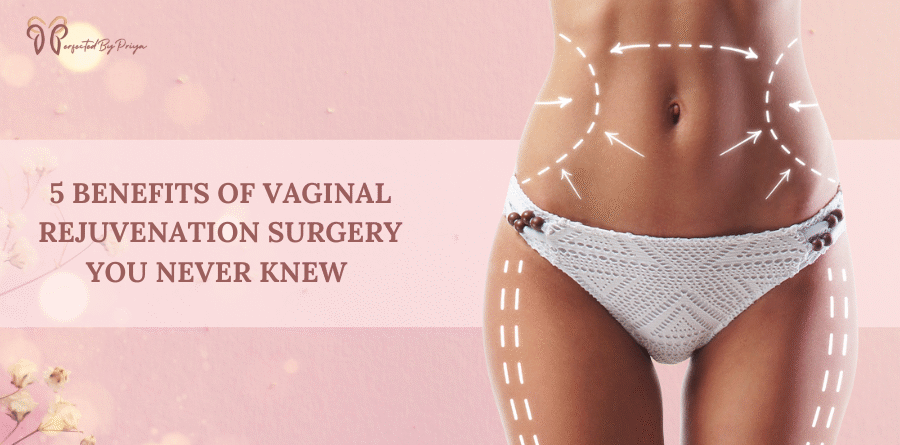 vaginoplasty
