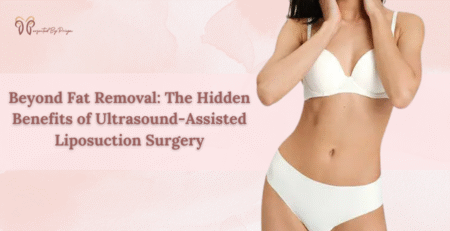 liposuction surgery in delhi