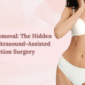liposuction surgery in delhi