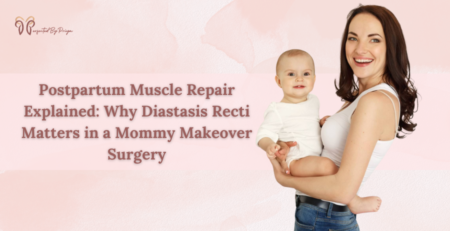 Mommy Makeover Surgery in India