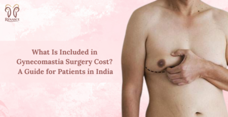 gynecomastia surgery